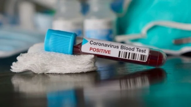 corona-virus-covid19